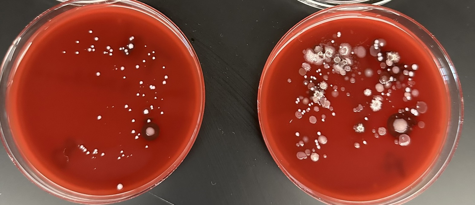 Two bacterial plates